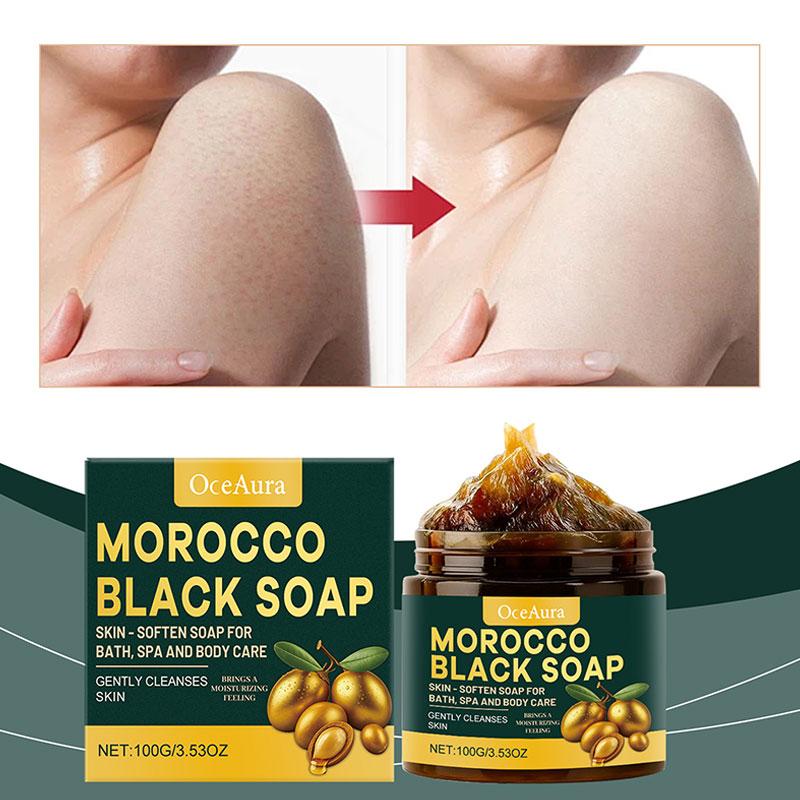 Moroccan Black Soap Deep Clean - مراجعة Castor Oil Soap وسعره